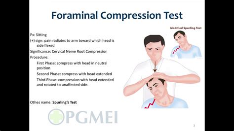 compression test spine|jackson compression test vs spurling's.